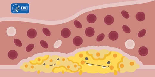 Cholesterol-Monster2