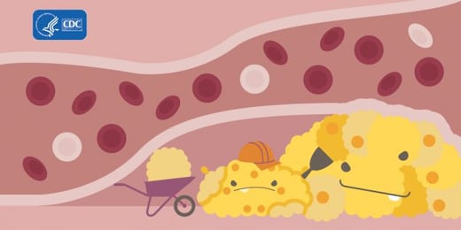 Cholesterol-Monster3-medium