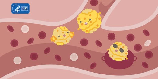 Cholesterol-Monster4